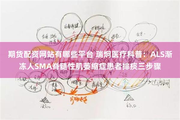 期货配资网站有哪些平台 瑞炯医疗科普：ALS渐冻人SMA脊髓性肌萎缩症患者排痰三步骤